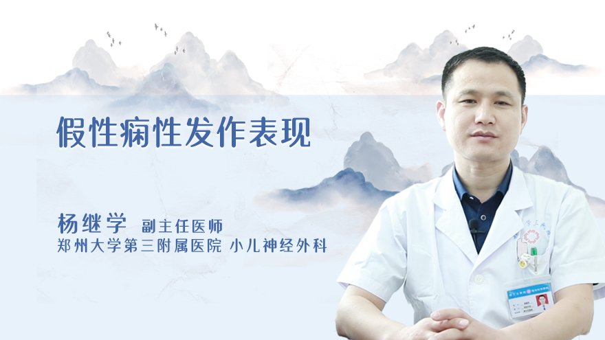假性痫性发作表现