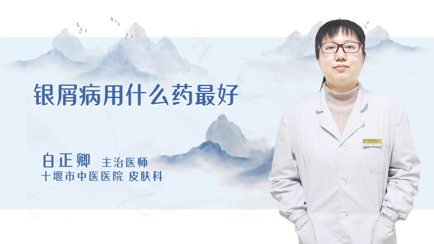 银屑病用什么药最好