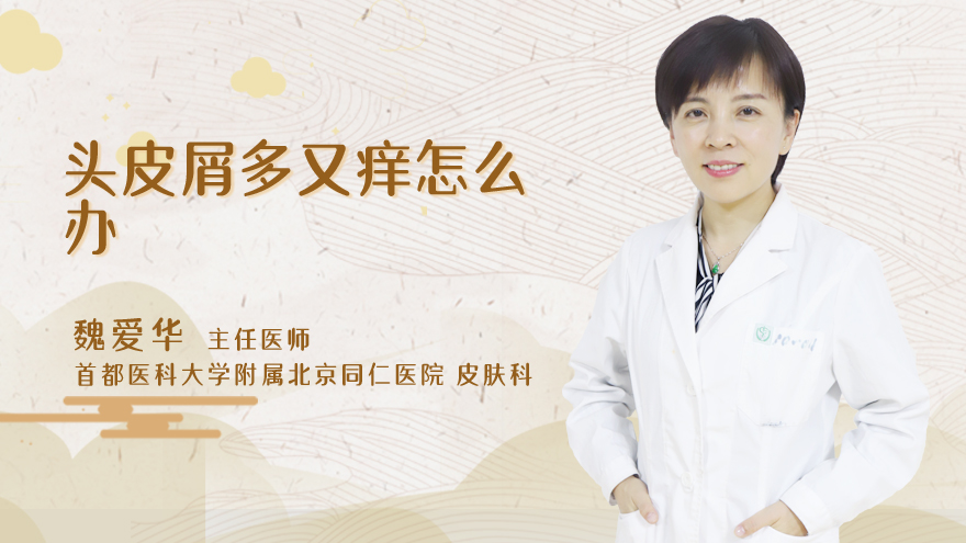 头皮屑多又痒怎么办