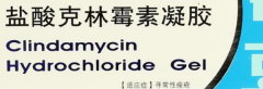 什么东西可以祛闭口粉刺，三种药膏祛除闭口粉刺